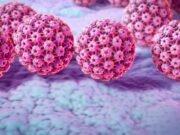 România: primul loc în UE la rata mortalității cauzată de HPV România: primul loc în UE la rata mortalității cauzată de HPV